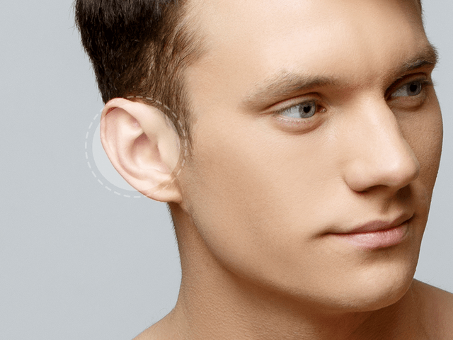 Depilação a Laser Masculina: Orelha