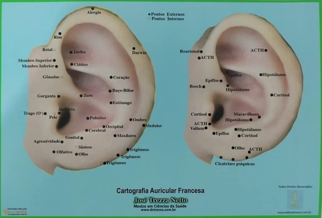 Cartografia Auricular Francesa