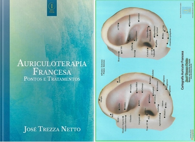 Mapa Cartografia Auricular Francesa - José Trezza Netto em Promoção na  Americanas