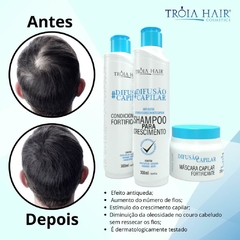 Hair Growth and Anti Hair Loss Kit Unisex - Troia Hair Diffusion - buy online