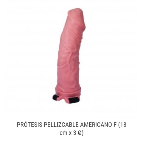 PROTESIS PENEANA