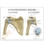 Ombro de Osteoartrite (OA) em 4 estágios - comprar online