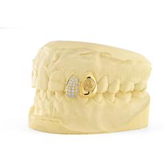 Aplique para dente Gold Vintage em Ouro Amarelo 18K e Diamantes - comprar online