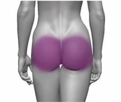 Depilação a Laser Gluteos