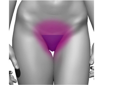 Depilação Laser Virilha Simples