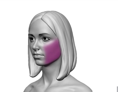Depilação Laser Face Completa