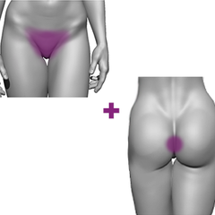 COMBO DEPILAÇÃO LASER 1