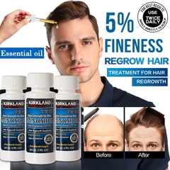 Minoxidil Kirkland - Tônico capilar para estimular o crescimento de novos fios de cabelo - 30- 50 - 60 ml - comprar online