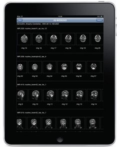 PACS IqWeb (Servidor Web Dicom)