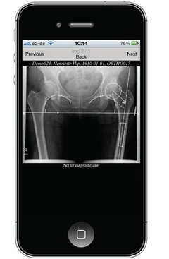 PACS IqWeb (Servidor Web Dicom) - comprar online