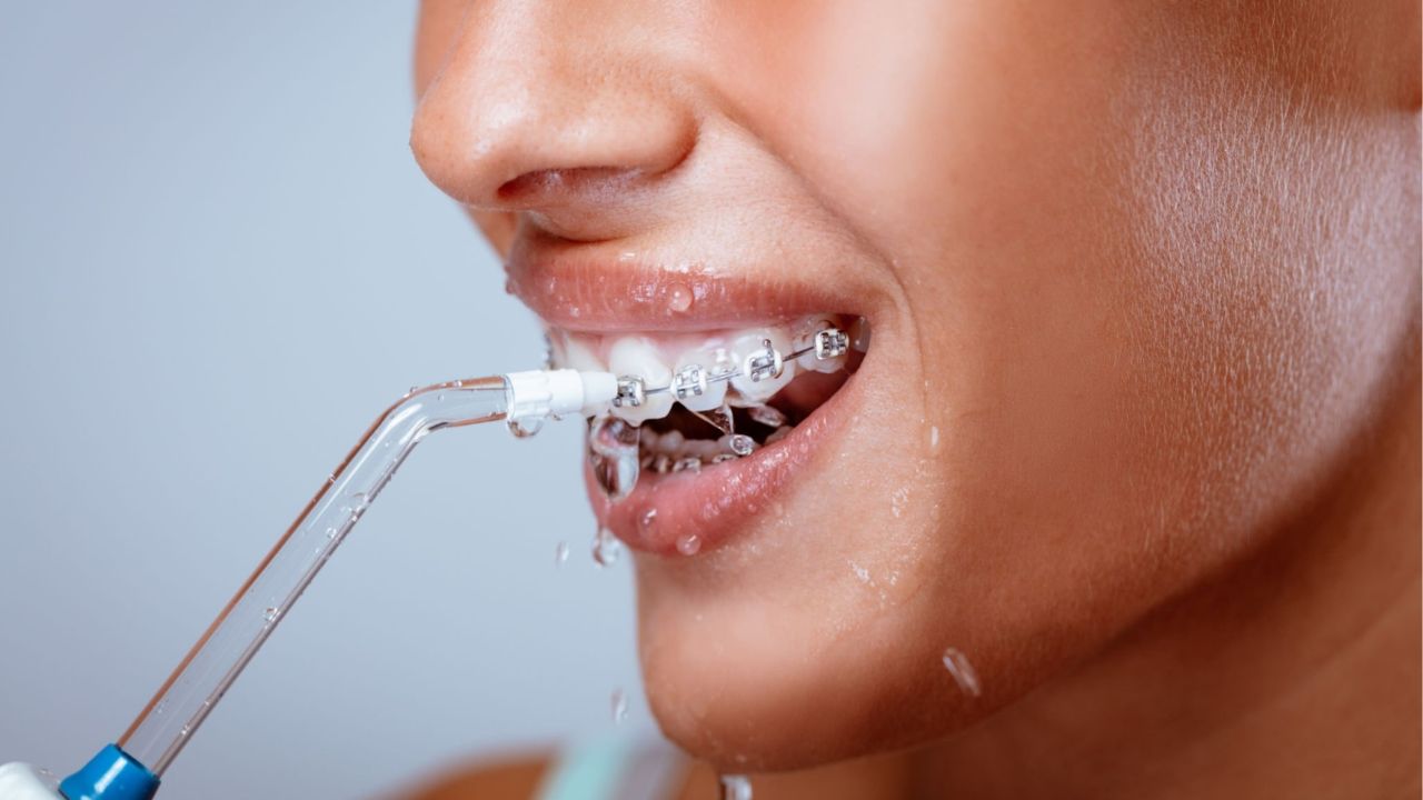 O que é um irrigador dental?