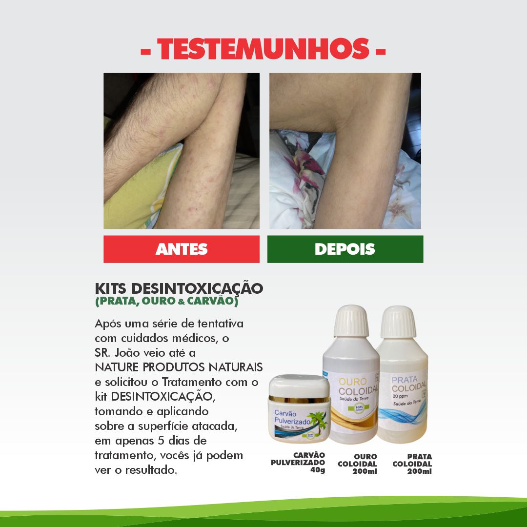 Tratamento com o kit DESINTOXICAÇÃO, tomando e aplicando sobre a superficie atacada, em apenas 7 dias de tratamento, vocês ja podem ver o resultado.