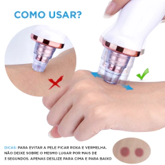 Imagem do Removedor de cravos e espinhas