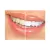 1 Seringa Clareador Dental Whiteness Class 7,5% - FGM na internet