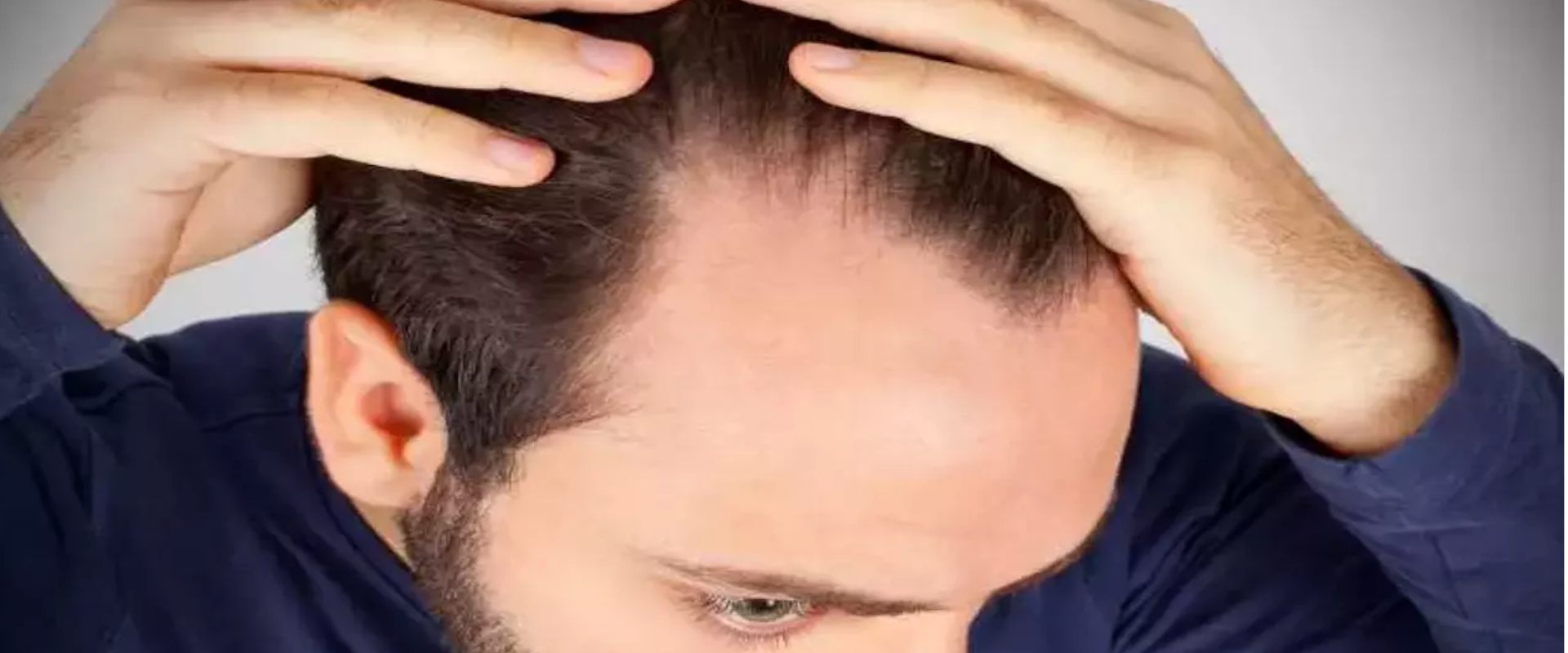 Creatina Causa Queda de Cabelo?