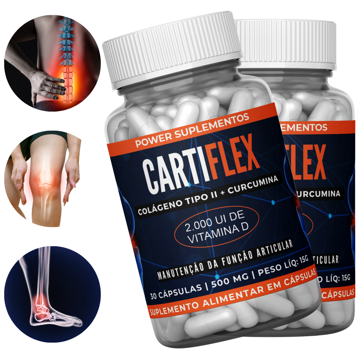 Cartiflex | Colágeno Tipo 2 + Curcumina + Vitamina D Para Alivio das Dores Nas Articulações, Juntos e Ossos