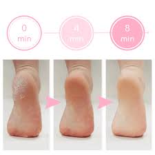 Removedor de Calos e Rachaduras dos Pés - Removedor de Calos Elétrico –  Saúde no Cotidiano