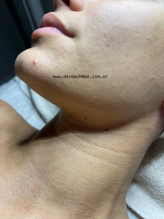 Imagen de Circuito 3 hs Corporal y Facial con Dermopulido + Limpieza de Cutis + Tratamiento para Piernas