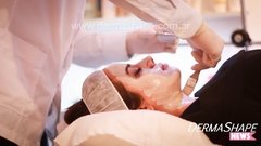 I- PEELING FACIAL de 6 SEIS PASOS.