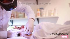 Limpieza Facial para hombres en palermo capital federal - limpieza de cutis con puntos negros y tratamientos  a domicilio en buenos aires
