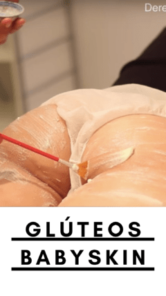 K - Peeling de Glúteos + Puntas de Diamante para Piel Engrosada, Apagada y con Granitos - limpieza de cutis con puntos negros y tratamientos  a domicilio en buenos aires