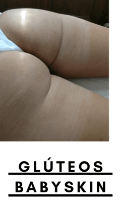 K - Peeling de Glúteos + Puntas de Diamante para Piel Engrosada, Apagada y con Granitos - comprar online