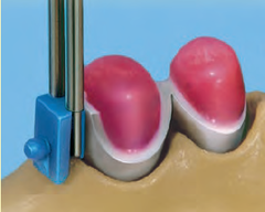 ATACHE BOLA VARIO SNAP VKS-SG 1.7 - 2.2
