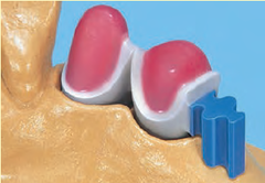 ATACHE RIELERA HORIZONTAL Y/O VERTICAL