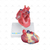 Modelo Patológico do Coração com Hipertrofia em 2 Partes - SD-5214 - Sdorf Scientific