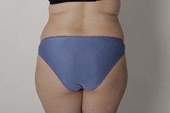 Vedetina mujer atras