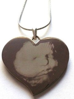 Ecografia Foto Medalla Llavero Ó Cadena Baby Shower