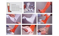 3M - Yesos Scothcast Plus - Fer Medical SRL : : Insumos Médicos