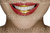 Millionaire Lips 3