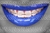 ORTHO GLOSS 8 blue