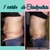 Lipolaser de 16 pad. IMPORTANTE, LOS ENVIOS GRATIS SOLO SON EN ARGENTINA. u$s751 - ISA-ARG
