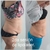 Lipolaser de 16 Pad modelo TS. IMPORTANTE, LOS ENVIOS GRATIS SOLO SON EN ARGENTINA. - ISA-ARG