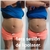 Lipolaser de 16 Pad modelo TS. IMPORTANTE, LOS ENVIOS GRATIS SOLO SON EN ARGENTINA. - tienda online